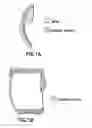 Fig. 02 - Positioning device for ankle joint replacement surgery