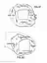 Fig. 09 - Positioning device for ankle joint replacement surgery