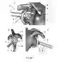Fig. 02 - Shoulder guides