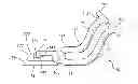 Fig. 01 - Apparatus for removing devices implanted in the body