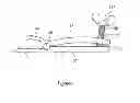 Fig. 04 - Apparatus for removing devices implanted in the body