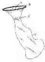 Fig. 01 - Pneumoperitoneum device