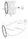 Fig. 02 - Pneumoperitoneum device