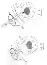 Fig. 35 - Pneumoperitoneum device