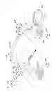 Fig. 44 - Pneumoperitoneum device