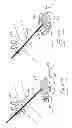 Fig. 45 - Pneumoperitoneum device