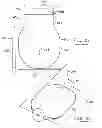 Fig. 77 - Pneumoperitoneum device