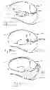 Fig. 83 - Pneumoperitoneum device