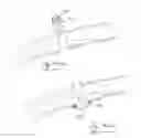 Fig. 85 - Pneumoperitoneum device