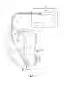 Fig. 02 - Wireless tissue electrostimulation