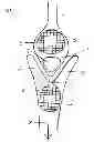 Fig. 02 - Medically Inspired Tick Removal Instrument