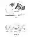 Fig. 05 - Suture passer with radiused upper jaw