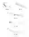Fig. 28 - Suture passer with radiused upper jaw
