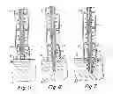 Fig. 04 - Method and apparatus for surgical fastening