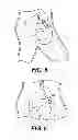 Fig. 07 - Self-assembling magnetic anastomosis device having an exoskeleton