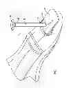 Fig. 02 - FINGERNAIL DRILL