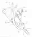 Fig. 01 - SYSTEMS AND METHODS FOR ACCOMODATING ANATOMICAL CHARACTERISTICS IN THE TREATMENT OF SEPTAL DEFECTS