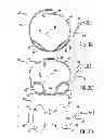 Fig. 06 - Anti-embolic device and method