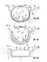 Fig. 08 - Anti-embolic device and method