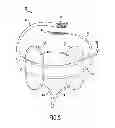 Fig. 09 - Anti-embolic device and method