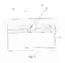 Fig. 08 - Bioresorbable detachable tip design for adhesive-based extravascular closure device