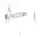 Fig. 07 - Iliosacral polyaxial screw