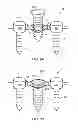 Fig. 07 - Variable angle bone plate with semi-constrained articulating screw