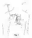 Fig. 02 - Criteria for optimal electrical resynchronization during fusion pacing