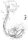 Fig. 03 - Criteria for optimal electrical resynchronization during fusion pacing