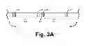 Fig. 05 - Criteria for optimal electrical resynchronization during fusion pacing