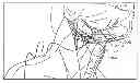Fig. 01 - Method of stimulating a hypoglossal nerve for controlling the position of a patient's tongue