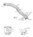 Fig. 04 - Method of stimulating a hypoglossal nerve for controlling the position of a patient's tongue