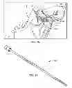 Fig. 07 - Method of stimulating a hypoglossal nerve for controlling the position of a patient's tongue