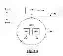 Fig. 05 - System for setting programmable parameters for an implantable hypertension treatment device