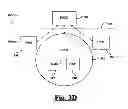 Fig. 07 - System for setting programmable parameters for an implantable hypertension treatment device