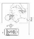 Fig. 04 - Cutaneous field stimulation with disposable and rechargeable components