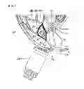 Fig. 09 - Devices and methods for non-invasive capacitive electrical stimulation and their use for vagus nerve stimulation on the neck of a patient