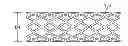 Fig. 01 - STENT FABRICATION VIA TUBULAR CASTING PROCESSES