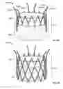 Fig. 06 - Prosthetic aortic heart valves