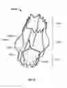 Fig. 07 - Prosthetic aortic heart valves