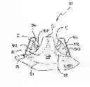 Fig. 01 - Aortic annuloplasty ring