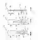 Fig. 06 - Aortic annuloplasty ring