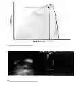 Fig. 03 - DEVICE AND METHOD FOR DETERMINING THE GRAFTING OF A RECIPIENT TISSUE SITE