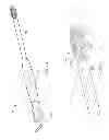 Fig. 15 - Expandable fusion device for positioning between adjacent vertebral bodies