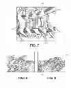 Fig. 08 - Implantable vertebral frame systems and related methods for spinal repair