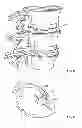 Fig. 06 - Systems and apparatuses for inserting an implant in intervertebral space