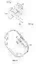 Fig. 07 - Systems and apparatuses for inserting an implant in intervertebral space