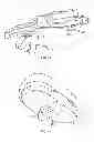 Fig. 08 - Systems and apparatuses for inserting an implant in intervertebral space