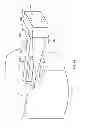 Fig. 28 - Systems and apparatuses for inserting an implant in intervertebral space