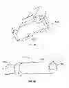 Fig. 33 - Systems and apparatuses for inserting an implant in intervertebral space
